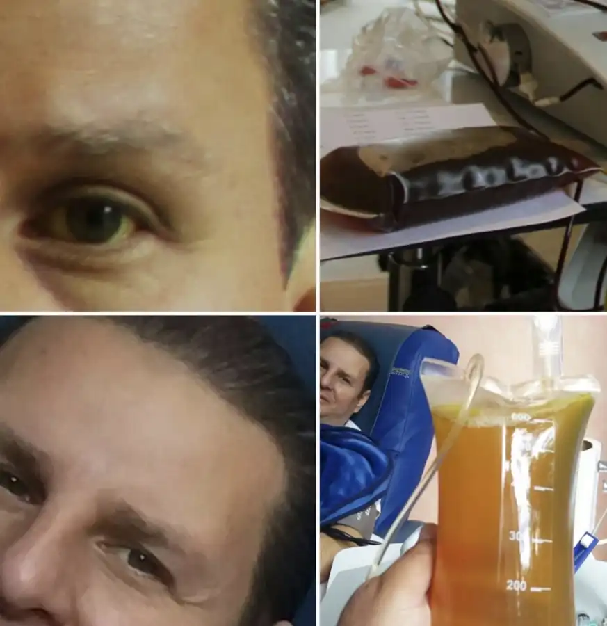 Observation collage with facial and eye details and plasma bags