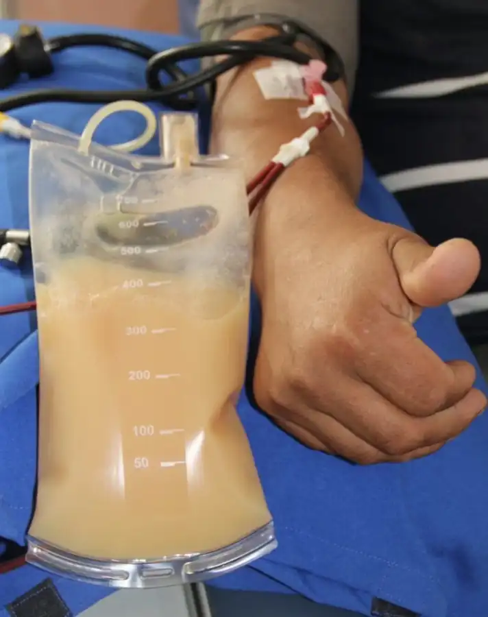 Plasma bag beside the patient’s arm during a procedure