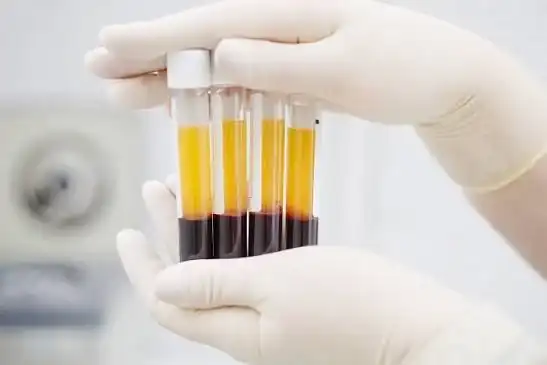 Gloved hands hold tubes with blood and separated fractions